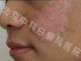 综֢״